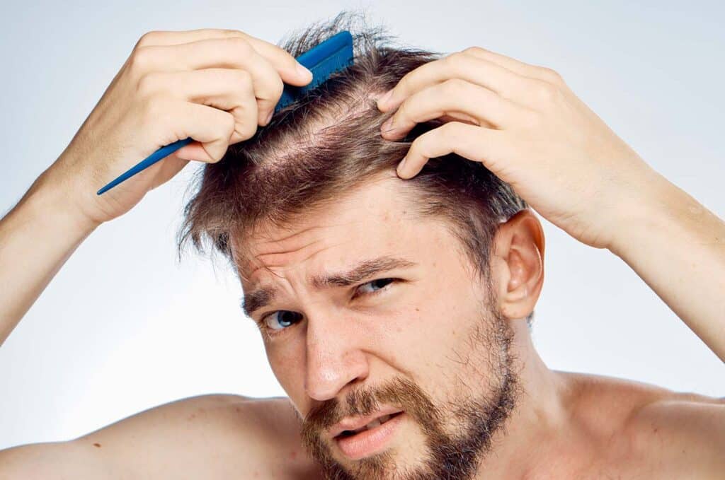 o que faz o cabelo cair resolva tratando natural
