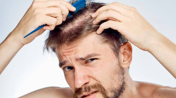 Pesquisa elenca melhores tratamentos para queda de cabelo masculino e feminino.